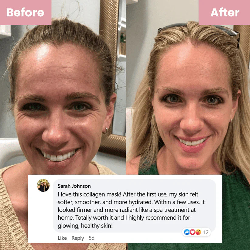 🏆Pamper Yourself — Buy 2 Collagen Night Masks, Get 1 Free! Wake Up to Youthful, Hydrated Skin!